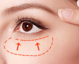 深圳福華中西醫(yī)結(jié)合醫(yī)院醫(yī)學(xué)美容科激光祛眼袋