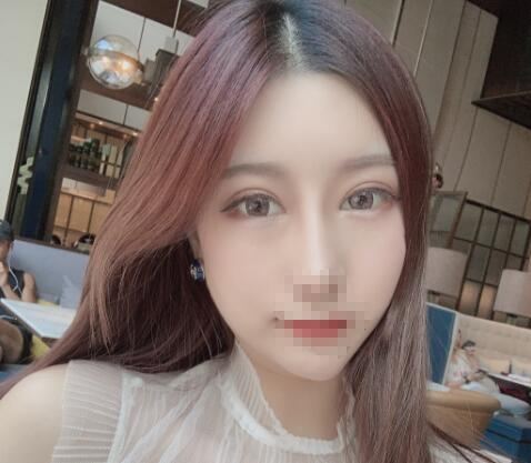 北京彤美整形醫(yī)院專家李長(zhǎng)賦做鼻部綜合整形怎么樣？