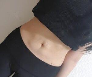 顧鵬腹部吸脂案例展示 顧鵬腹部吸脂案例展示