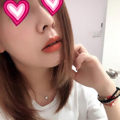 隆鼻之后: 隆鼻之后: