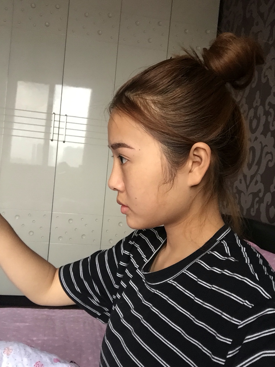 做完手術(shù)后