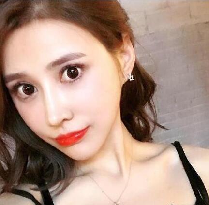 下頜角手術(shù)15天 下頜角手術(shù)15天