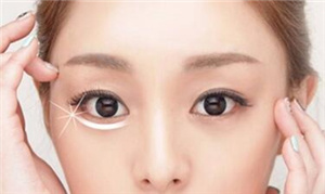 石家莊雅芳亞醫(yī)療美容醫(yī)院吸脂祛眼袋