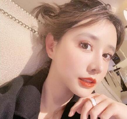 下頜角手術(shù)第7天 下頜角手術(shù)第7天