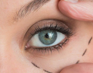 濰坊醫(yī)學院附屬醫(yī)院整形外科激光祛黑眼圈