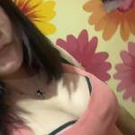 南寧伊美整形醫(yī)生凌宏量做自體脂肪隆胸怎么樣？自體脂肪隆胸案例