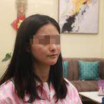 安徽立新醫(yī)學美容醫(yī)院程立新醫(yī)生面部吸脂案例效果對比圖