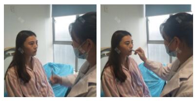 上海首爾麗格整形醫(yī)生魯峰一做自體脂肪全臉填充 上海首爾麗格整形醫(yī)生魯峰一做自體脂肪全臉填充