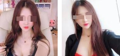 沈陽杏林整形美容醫(yī)院崔昌墉醫(yī)生做假體隆胸技術(shù)怎么樣？附案例