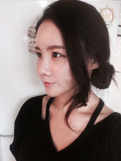 貴陽長江醫(yī)院整形美容中心韓盛斌醫(yī)生做自體脂肪隆鼻+全臉填充案例