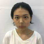 做完雙眼皮手術(shù)，不化妝也自帶美顏效果！