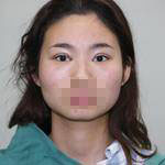 術(shù)前照片 術(shù)前照片