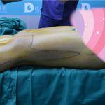 做完雙腿吸脂手術(shù)，穿上我的長筒靴，盡顯女性魅力！