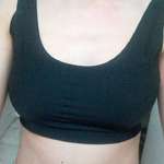 假體隆胸讓我徹底擺脫“太平洋”