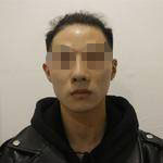 做完隆鼻失敗修復手術(shù)，再看自己儼然屬于超模中的一員了