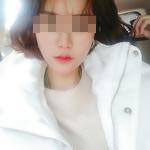 術(shù)后照片 術(shù)后照片