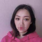 做完雙眼皮手術(shù)眼睛更加迷人了，眼睛自己會(huì)撩小哥哥