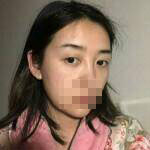 術(shù)前照片 術(shù)前照片