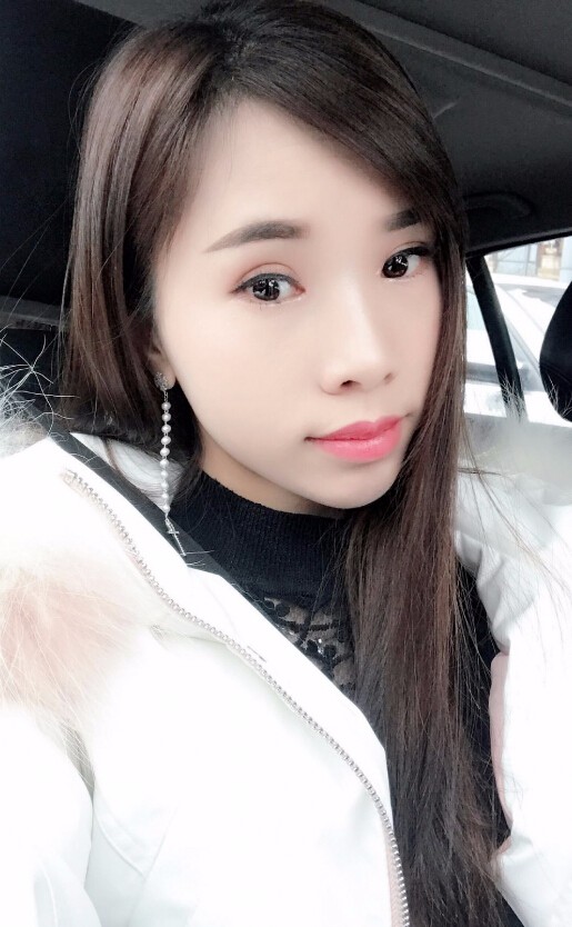 楊海平雙眼皮手術(shù)案例