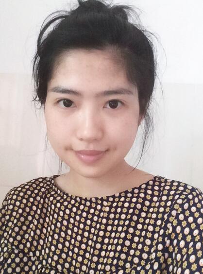 下頜角手術(shù)半個月