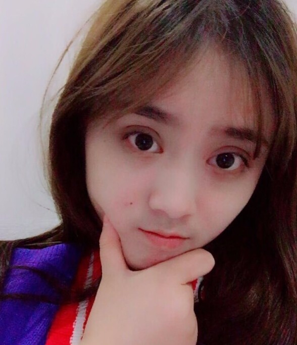 福州愛美爾整形黃林勝雙眼皮案例效果對比圖 福州愛美爾整形黃林勝雙眼皮案例效果對比圖