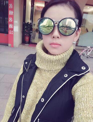 楊勇山雙眼皮案例展示