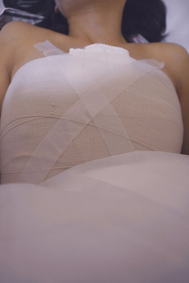 邯鄲凱潤(rùn)婷整形醫(yī)生馬戰(zhàn)勝做自體脂肪隆胸怎么樣？ 附馬戰(zhàn)勝自體脂肪隆胸案例