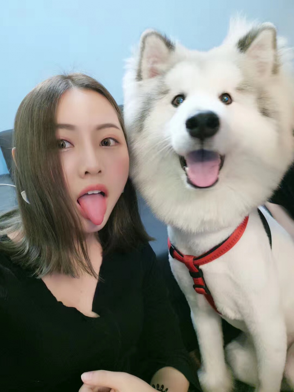 整形醫(yī)生徐長亮做切開雙眼皮案例效果對比圖