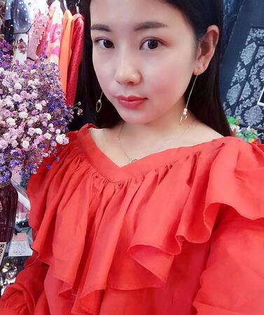 楊勇山雙眼皮案例展示