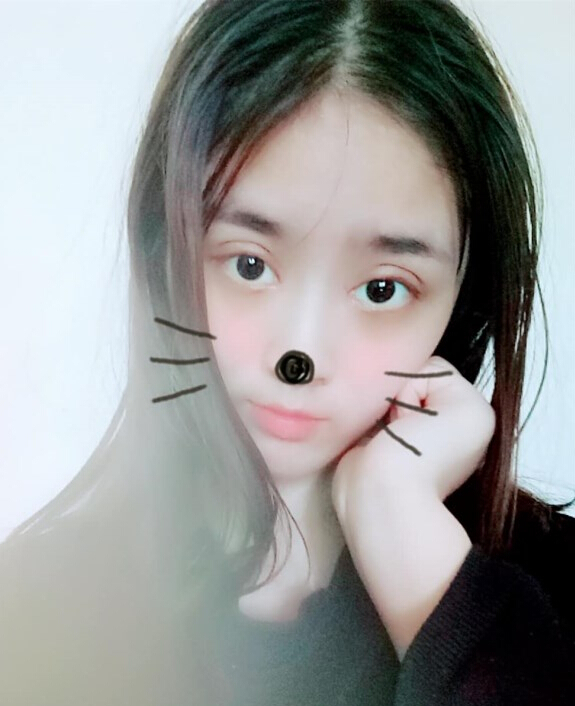 福州愛美爾整形黃林勝雙眼皮案例效果對比圖 福州愛美爾整形黃林勝雙眼皮案例效果對比圖