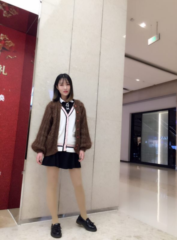 成都美立方整形醫(yī)院黃華醫(yī)生做大腿吸脂怎么樣？附大腿吸脂案例