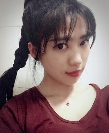 下頜角手術(shù)第三十五天