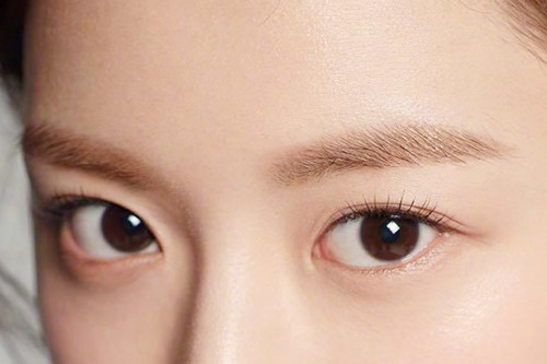 長春西之米醫(yī)療美容醫(yī)院激光去黑眼圈