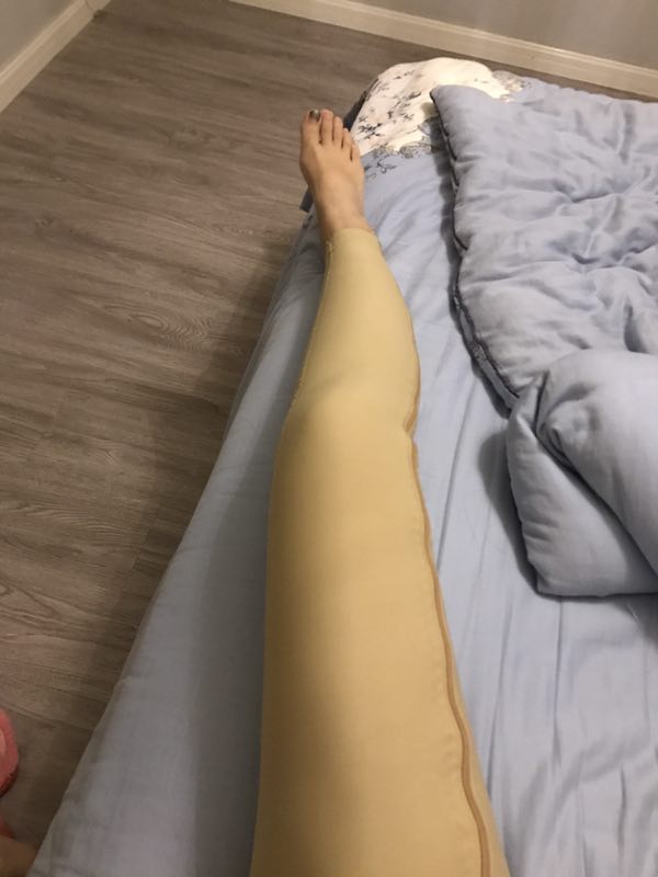 劉光偉全身吸脂案例