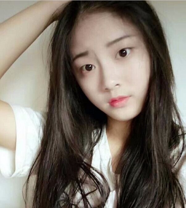 福州愛美爾整形黃林勝雙眼皮案例效果對比圖 福州愛美爾整形黃林勝雙眼皮案例效果對比圖