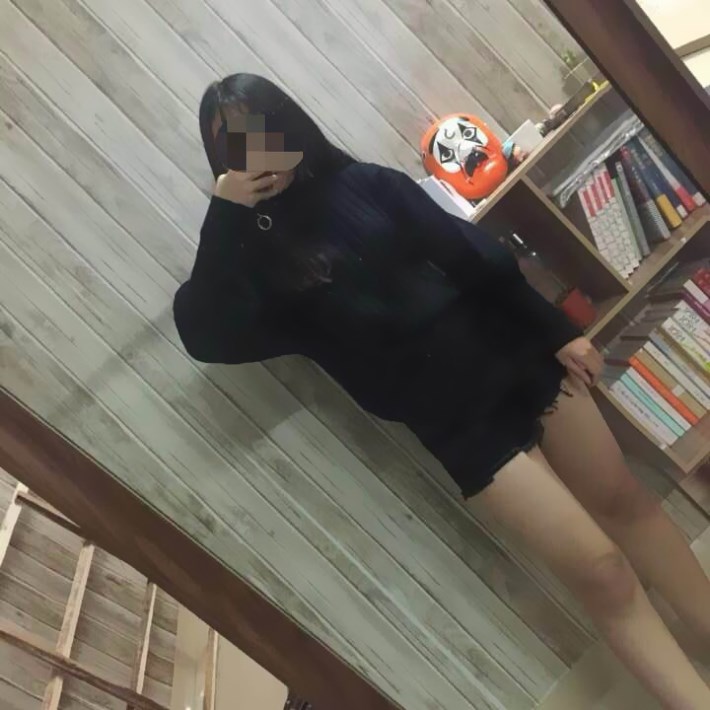 廣州軍頤醫(yī)院整形美容中心石建薇醫(yī)生腰腹吸脂真實(shí)案例對(duì)比圖 廣州軍頤醫(yī)院整形美容中心石建薇醫(yī)生腰腹吸脂真實(shí)案例對(duì)比圖