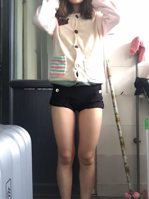 成都美立方整形醫(yī)院黃華醫(yī)生做大腿吸脂怎么樣？附大腿吸脂案例