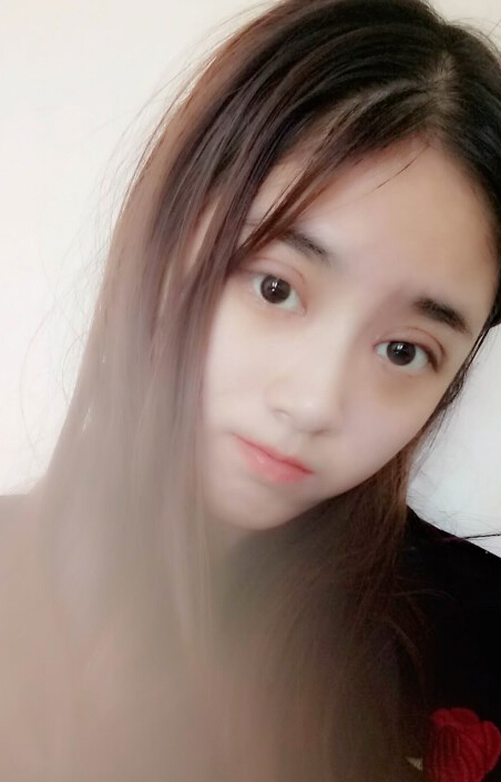 福州愛美爾整形黃林勝雙眼皮案例效果對比圖 福州愛美爾整形黃林勝雙眼皮案例效果對比圖