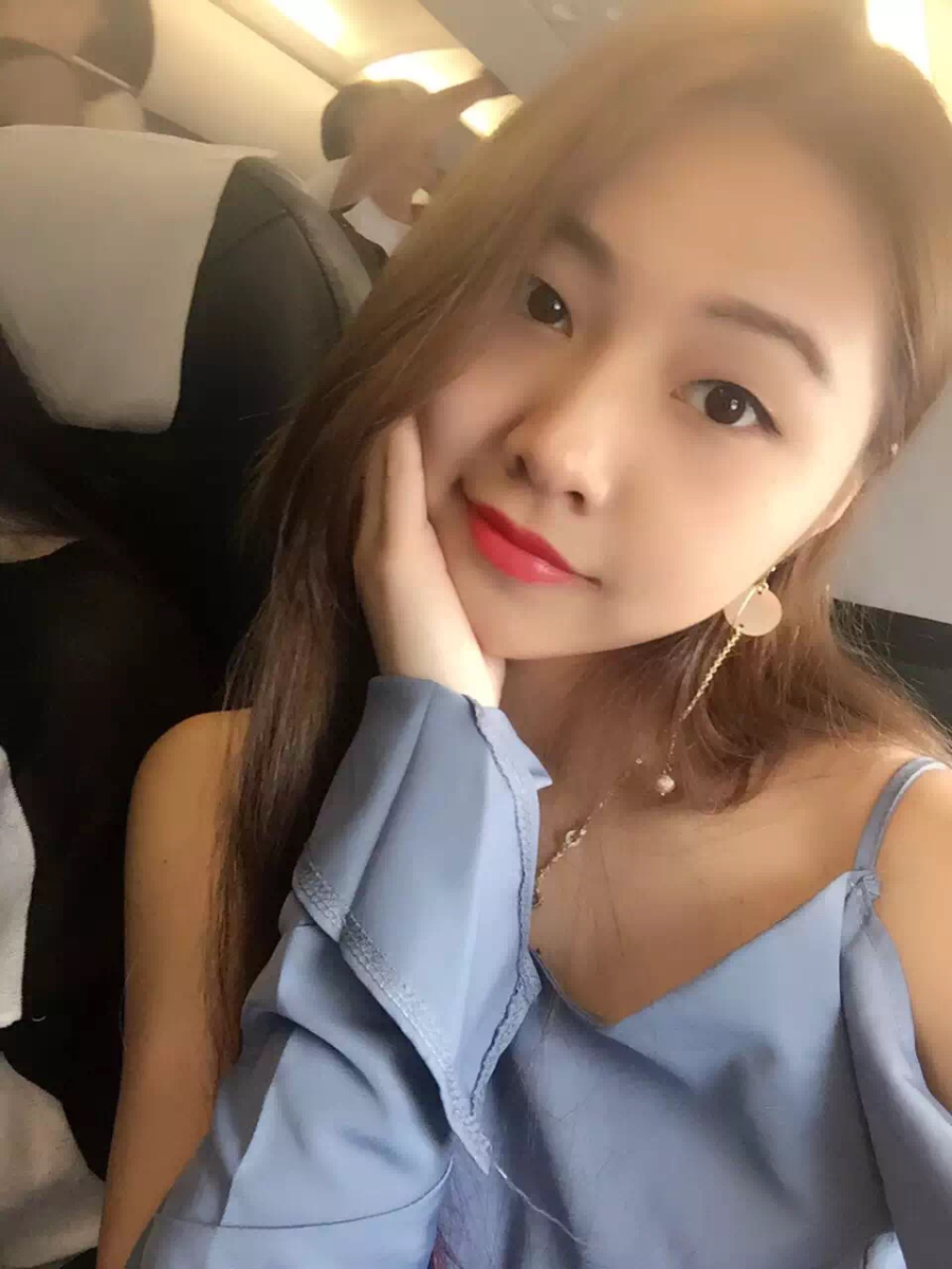 廣州中科美整形醫(yī)生徐長(zhǎng)亮做切開雙眼皮怎么樣？附切開雙眼皮案例