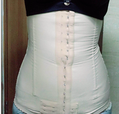 深圳晨曦整形醫(yī)院吉米斯做腰腹吸脂怎么樣？附吉米斯醫(yī)生腰腹吸脂案例