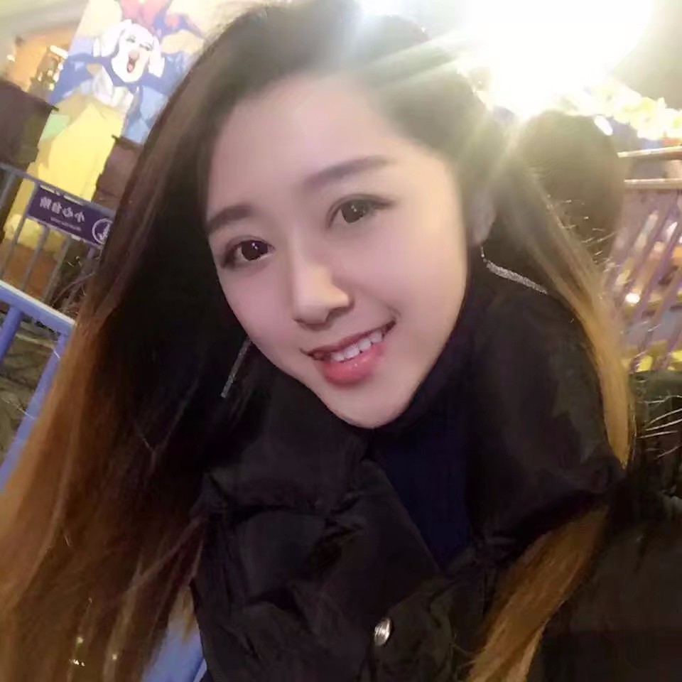 西安米蘭柏羽整形醫(yī)院李旭平做切開雙眼皮效果怎么樣？附案例