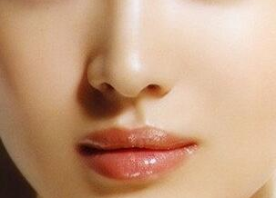 常州美麗陽光整形假體隆鼻