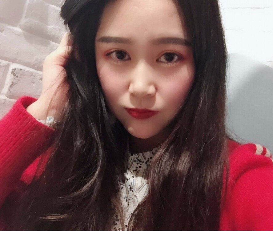 趙煜楠醫(yī)生硅膠墊下巴真人案例