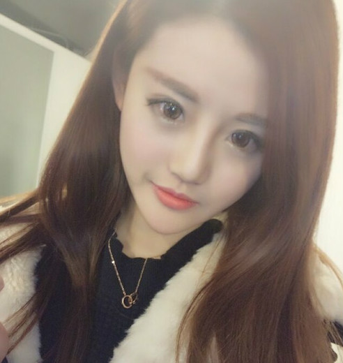 深圳鵬愛整形醫(yī)院湯月碧醫(yī)生做下頜角磨骨怎么樣？附下頜角磨骨案例