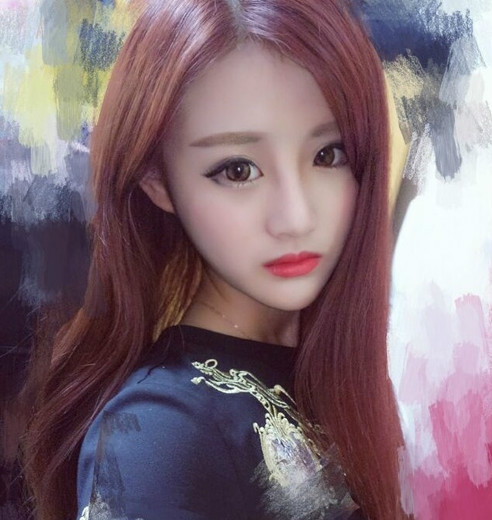 下頜角磨骨六個(gè)月后