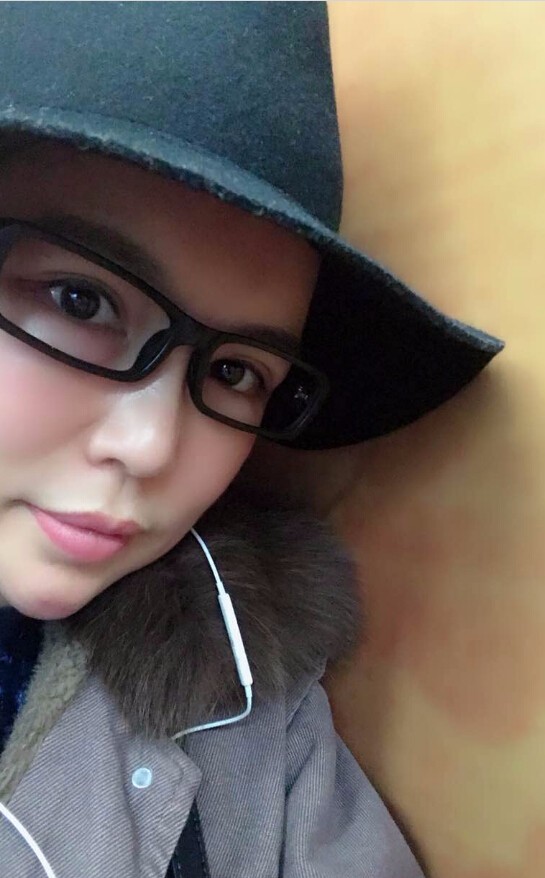 重慶聯(lián)合麗格美容醫(yī)院林麗蓉醫(yī)生做自體脂肪豐蘋果肌怎么樣？附案例