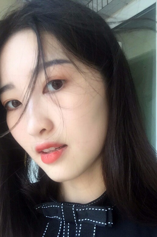 鄭州正合口腔門診部做牙齒矯正怎么樣？附郭毅醫(yī)生牙齒金屬托槽矯正案例