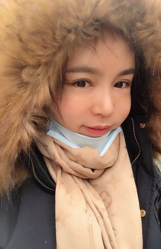 重慶聯(lián)合麗格美容醫(yī)院林麗蓉醫(yī)生做自體脂肪豐蘋果肌怎么樣？附案例