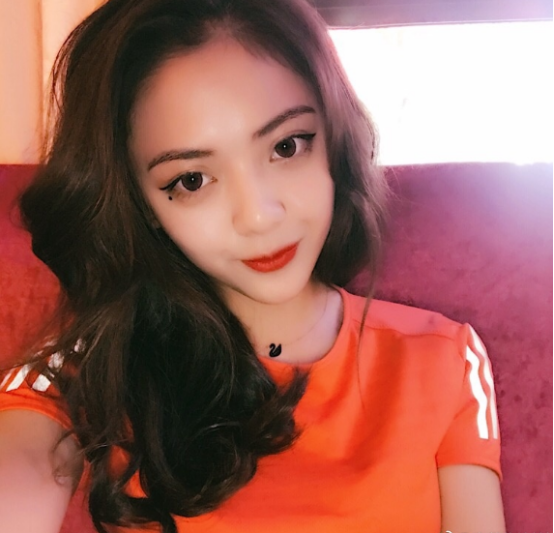 珠海平安康復(fù)醫(yī)院整形美容中心查元坤醫(yī)生面部吸脂案例效果對(duì)比圖