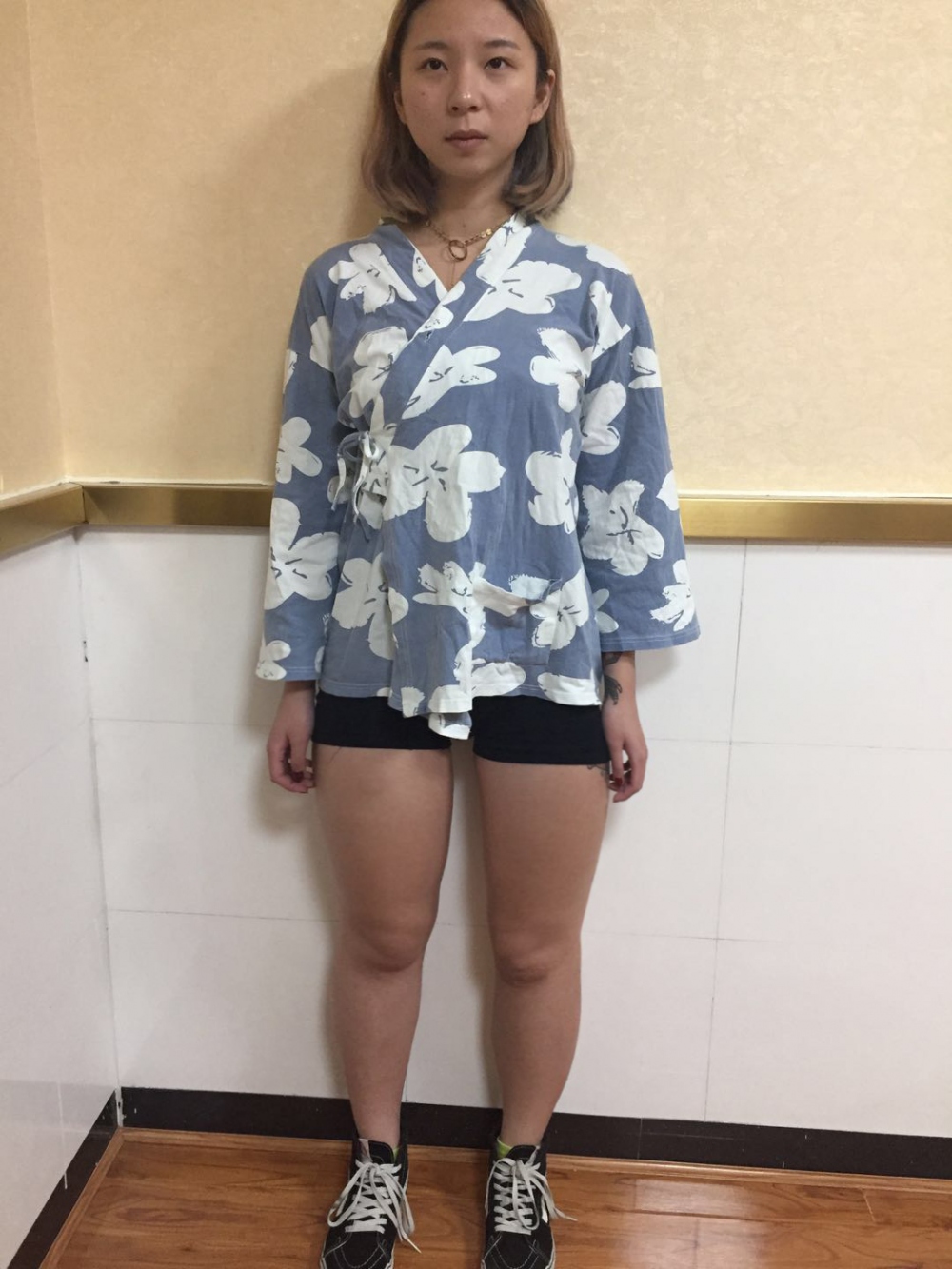 深圳鵬愛醫(yī)療整形醫(yī)生張建文做大腿吸脂怎么樣？附大腿吸脂案例效果對比圖